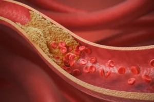 10 alimentos que cardiologistas indicam para baixar o colesterol