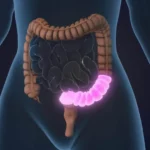 4 regras obrigatórias para proteger o intestino ao tomar antibióticos