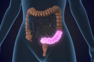 4 regras obrigatórias para proteger o intestino ao tomar antibióticos