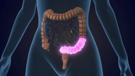 4 regras obrigatórias para proteger o intestino ao tomar antibióticos