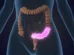 4 regras obrigatórias para proteger o intestino ao tomar antibióticos