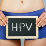 Alerta: HPV mata 7,5 mil por ano no Brasil e câncer avança entre jovens