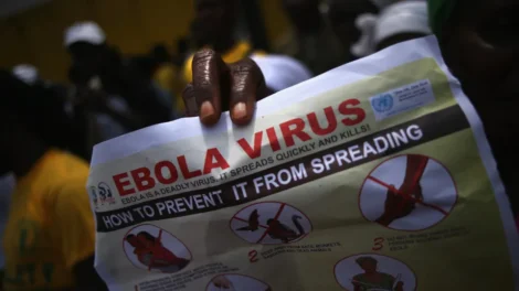 Congo confirma 100 mortes por ebola, e Seis norte-americanos são monitorados