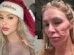 Ex-modelo que teve rosto 'derretido' revela origem da doença