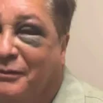 Leonardo revela fratura no rosto após queda em pescaria