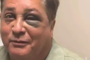Leonardo revela fratura no rosto após queda em pescaria