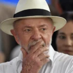 Lula faz radioterapia após retirar lesão de câncer de pele no couro cabeludo