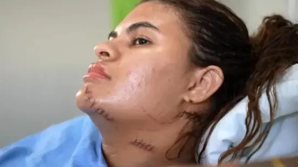 'Me fiz de morta', diz estudante que teve as mãos amputadas em ataque com foice no Ceará