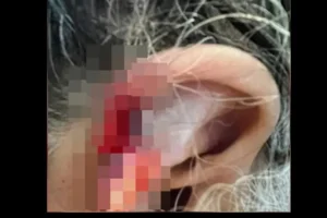 Neto arranca pedaço da orelha da avó e diz à polícia que engoliu