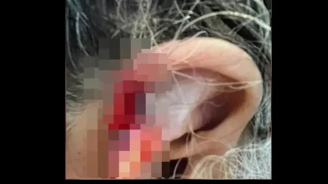Neto arranca pedaço da orelha da avó e diz à polícia que engoliu
