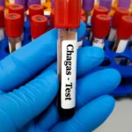 Risco cardíaco dobra para pacientes com doença de Chagas após cirurgia