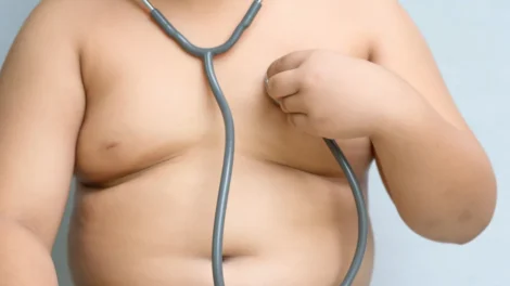 5 mitos sobre a obesidade infantil que ainda preocupam especialistas
