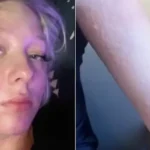 Adolescente sofre queimaduras ao tomar banho nos EUA, e família culpa água
