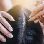 Arrancar cabelo branco faz nascer mais fios? Dermatologista esclarece