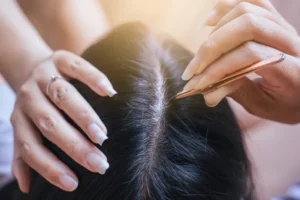 Arrancar cabelo branco faz nascer mais fios? Dermatologista esclarece