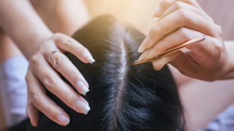 Arrancar cabelo branco faz nascer mais fios? Dermatologista esclarece