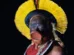 Cacique Raoni tem 'evolução clínica favorável', mas segue na UTI