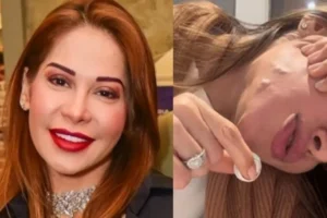 Famosas admitem seus maiores arrependimentos de beleza: "Não façam"