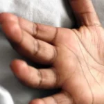 Menino de 11 anos morre após suspeita de envenenamento com bolo no RJ