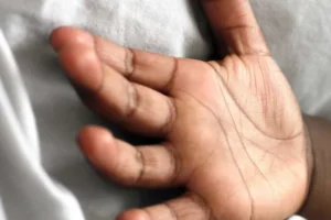 Menino de 11 anos morre após suspeita de envenenamento com bolo no RJ