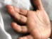Menino de 11 anos morre após suspeita de envenenamento com bolo no RJ