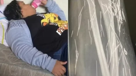 Mulher que fingiu ter 12 anos relatou agulhas no corpo