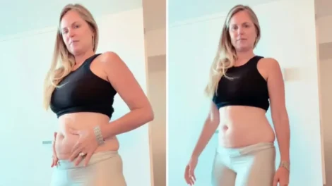 Susana Werner inicia tratamento com caneta emagrecedora e expõe luta contra a balança