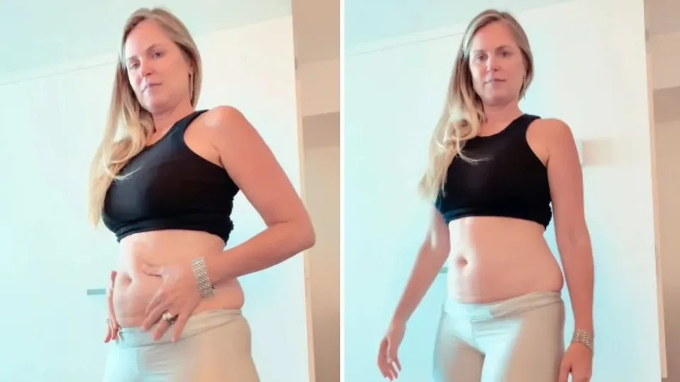 Susana Werner inicia tratamento com caneta emagrecedora e expõe luta contra a balança