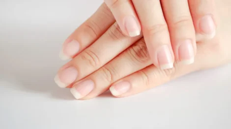 Alteração nas unhas pode ser sinal de câncer de pulmão; entenda