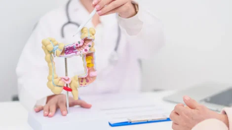 Câncer colorretal: veja quais exames preventivos fazer e em qual idade
