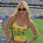 Celebridades que sofrem de alopecia e podem ficar carecas