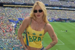 Celebridades que sofrem de alopecia e podem ficar carecas