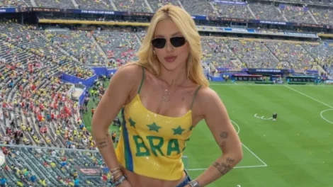 Celebridades que sofrem de alopecia e podem ficar carecas