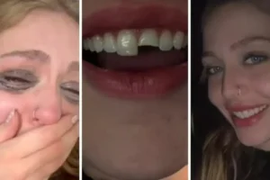Jovem quebra dente na balada no PR, cola na madrugada e volta para a festa