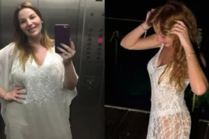 Luiza Zveiter recorda sequelas após bariátrica