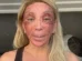 'Não consigo nem rir', diz Maya Massafera mostra rosto inchado após peeling e ironiza reação: 'Não consigo nem rir'