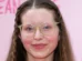 Atriz de 'Harry Potter' diz que ganhou mais dinheiro em um ano no OnlyFans do que durante toda a sua carreira