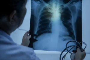 Entenda quando uma infecção respiratória pode evoluir para pneumonia