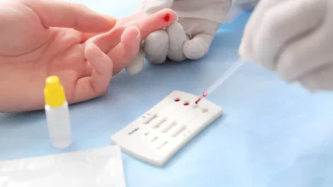 Estudo sobre hepatites virais traça panorama da doença em onze anos