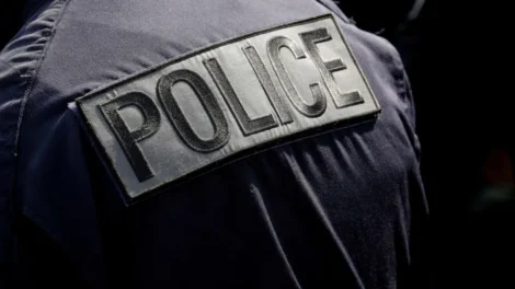 França: Mulher arranca parte da língua do marido com beijo e o atropela
