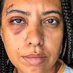 Influenciadora leva seis pontos após agressão em roda de samba no Rio