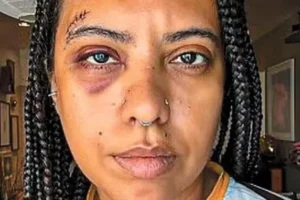Influenciadora leva seis pontos após agressão em roda de samba no Rio