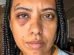 Influenciadora leva seis pontos após agressão em roda de samba no Rio