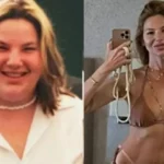 Irreconhecível: Repórter da Globo perde 70kg e 8 dentes após bariátrica