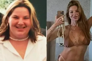 Irreconhecível: Repórter da Globo perde 70kg e 8 dentes após bariátrica