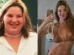 Irreconhecível: Repórter da Globo perde 70kg e 8 dentes após bariátrica