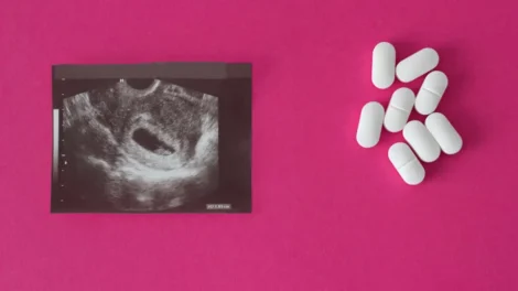 Metade das crianças grávidas com menos de 14 anos não recebe opção de aborto legal, diz pesquisa