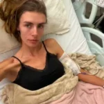 Modelo fala sobre internação em estado grave por anorexia