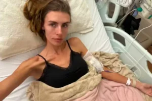 Modelo fala sobre internação em estado grave por anorexia