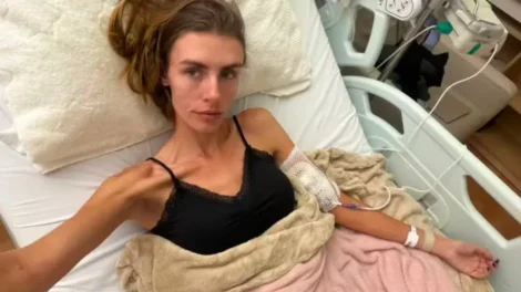 Modelo fala sobre internação em estado grave por anorexia